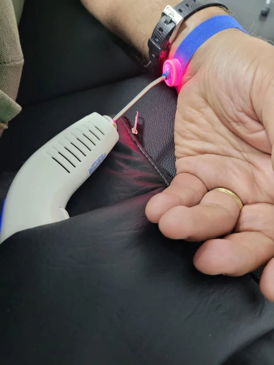 Aplicação de laser no pulso (ILIB)